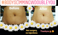 Album Skin Treatment W Double You